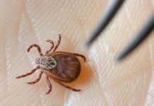 Einer Expertin zufolge steigt die Wahrscheinlichkeit einer Borrelien-Infektion etwa 16 bis 20 Stunden nach einem Stich. (Archivbild)