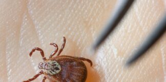 Einer Expertin zufolge steigt die Wahrscheinlichkeit einer Borrelien-Infektion etwa 16 bis 20 Stunden nach einem Stich. (Archivbild)