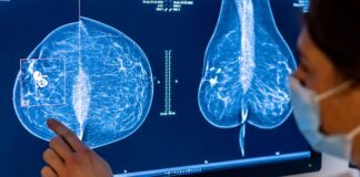 Krebs-Behandlungen in Kliniken: Lungenkrebs am häufigsten Das Amt für Statistik Berlin-Brandenburg hat die Daten anlässlich des Weltkrebstags am Mittwoch veröffentlicht. (Symbolbild)